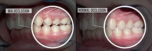 Cedar Knolls Dental Group | Implant Dentistry, Digital Radiography and Veneers