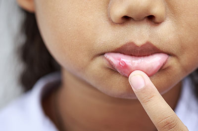 Cedar Knolls Dental Group | Veneers, Pediatric Dentistry and Dental Fillings
